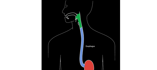 Esophageal cancer background