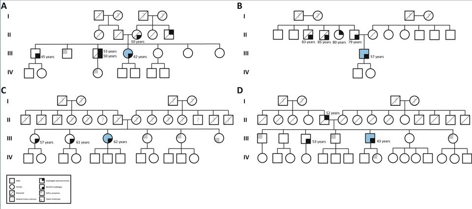 Importance of family history in Barrett's and esophageal adenocarcinoma